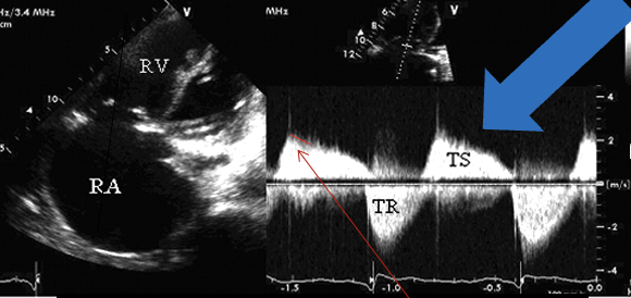 <p>The blue arrow is ?</p>
