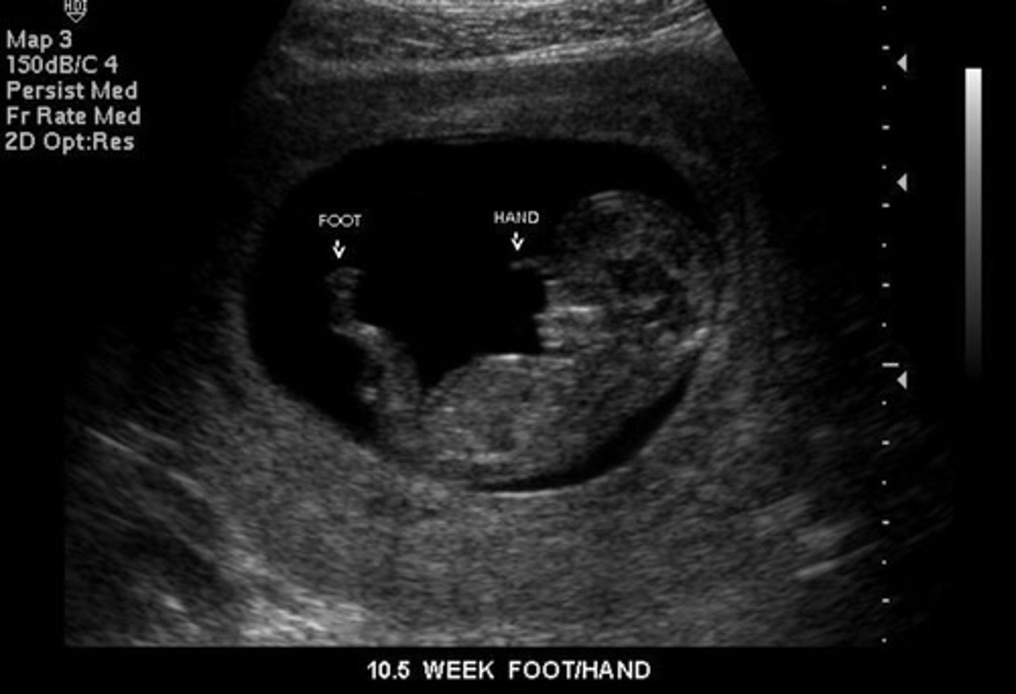 <p>Unwebbed hands + feet</p><p>Brain completely formed</p><p>Eyelids formed</p>
