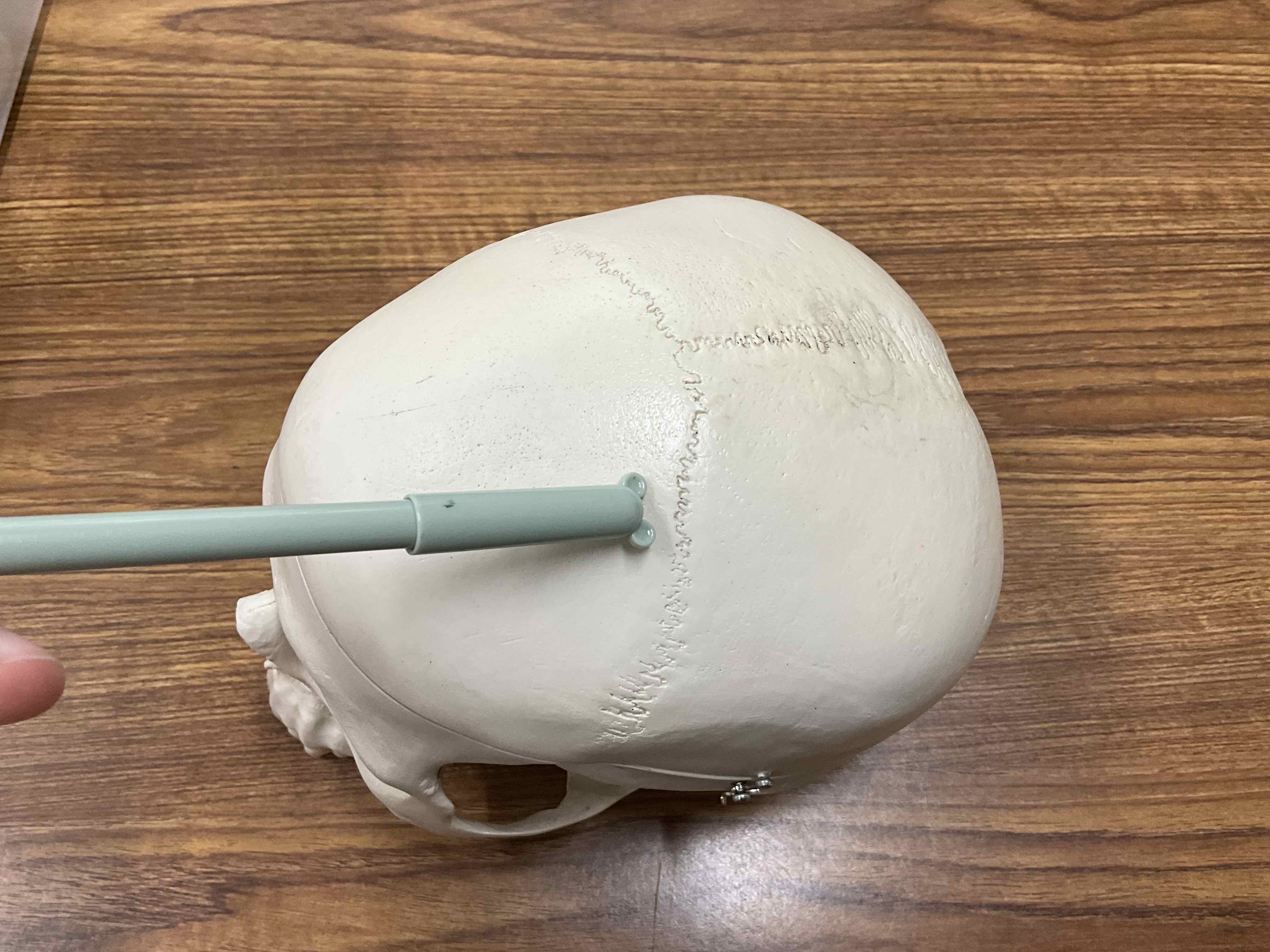 <p>Suture</p>