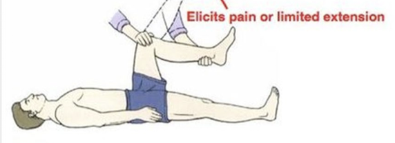 <p>Extension of the knee is painful or limited in extension</p>