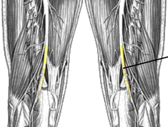 <p>Which nerve of the sacral plexus is:</p><ul><li><p>Extends from sciatic nerve</p></li><li><p>Starts from knee runs down to feet</p></li></ul><p></p>