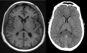 <p>a type of imaging technology that uses magnetic fields and radio waves to create detailed images of the organs and tissues within the body. <strong>Shows structure</strong></p>