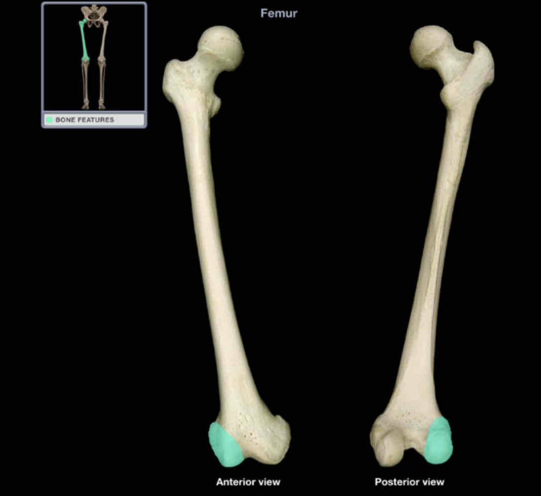 <p>Lateral condyle of femur</p>