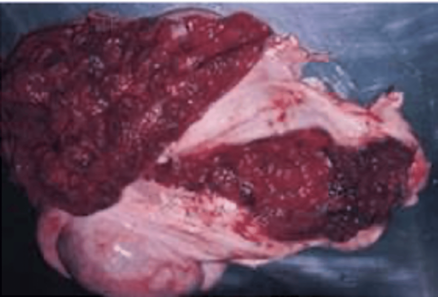 <p>- puede ser asintomático</p><p>infec. local:</p><p>- enteritis</p><p>- mastitis</p><p>- conjunctivitis</p><p>- infec. genitales</p><p>infec. sistémica:</p><p>- abortos a término: sin lesiones del feto + material purulento amarillento del placenta (placentitis intercotiledónica)</p><p>- neumonía</p><p>- poliartritis</p><p>- mamitis</p><p>- encefalomielitis</p><p>también pueden haber infecciones latentes → inmunosupresión</p>