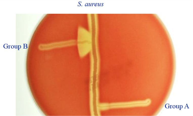 <p>The photo shows an example of what kind of test?</p>
