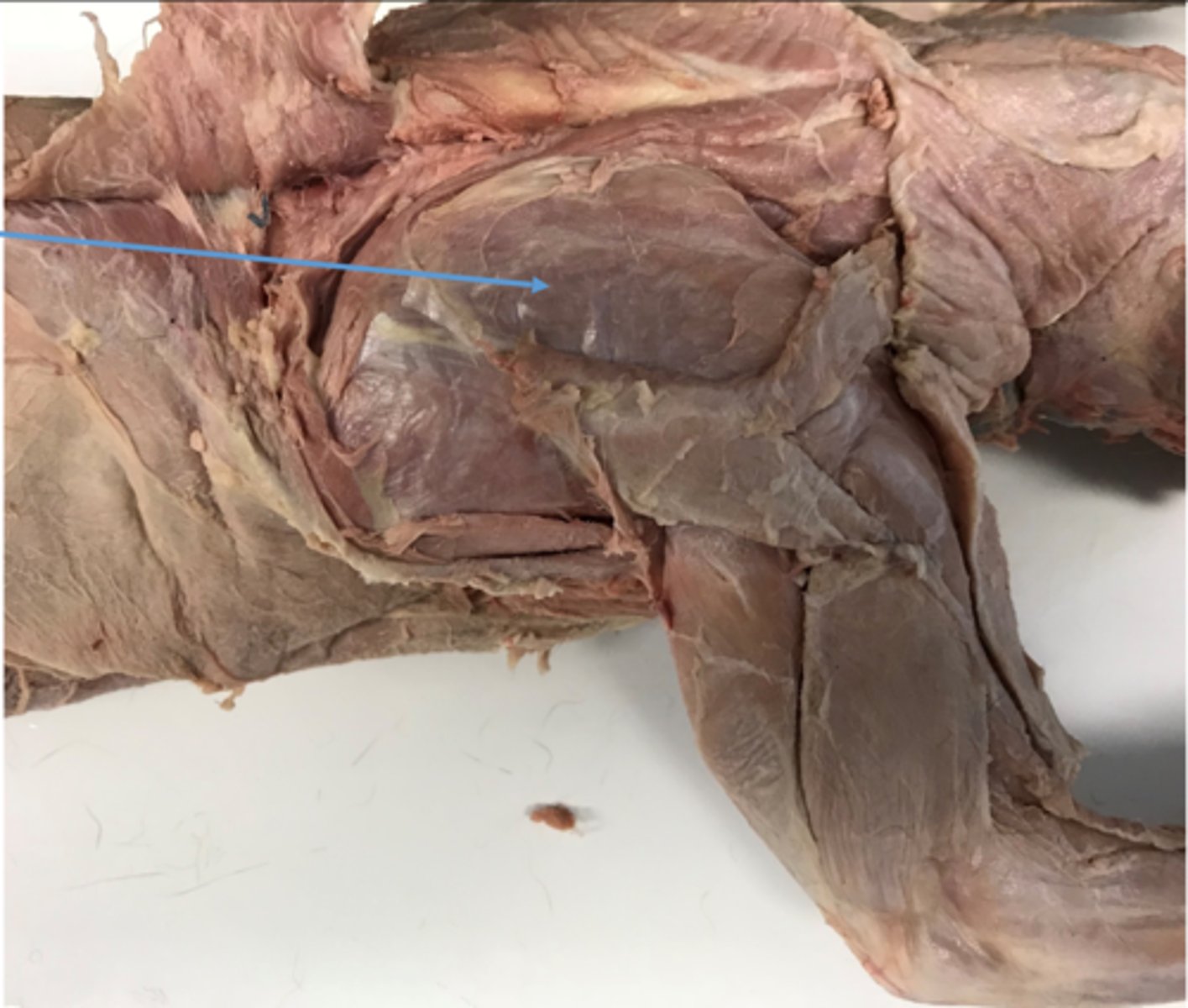 <p>name this muscle</p>