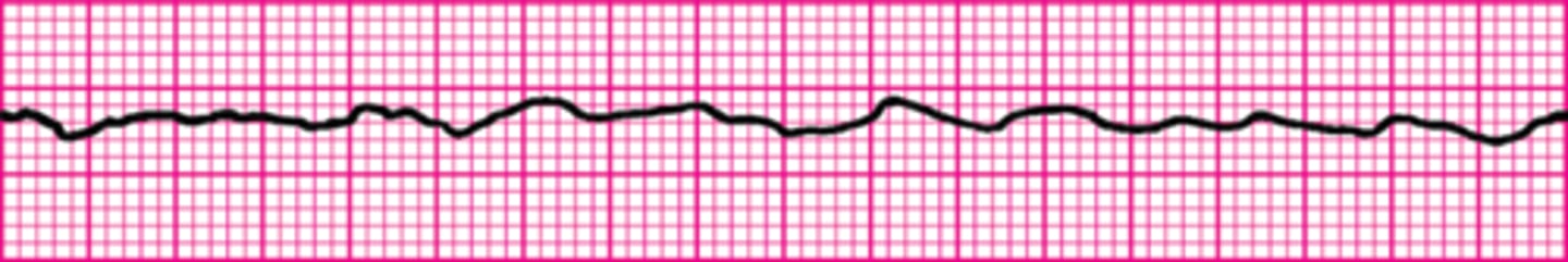 <p>Epinephrine 1 mg IV</p>