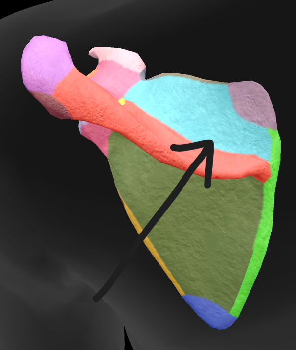 term image