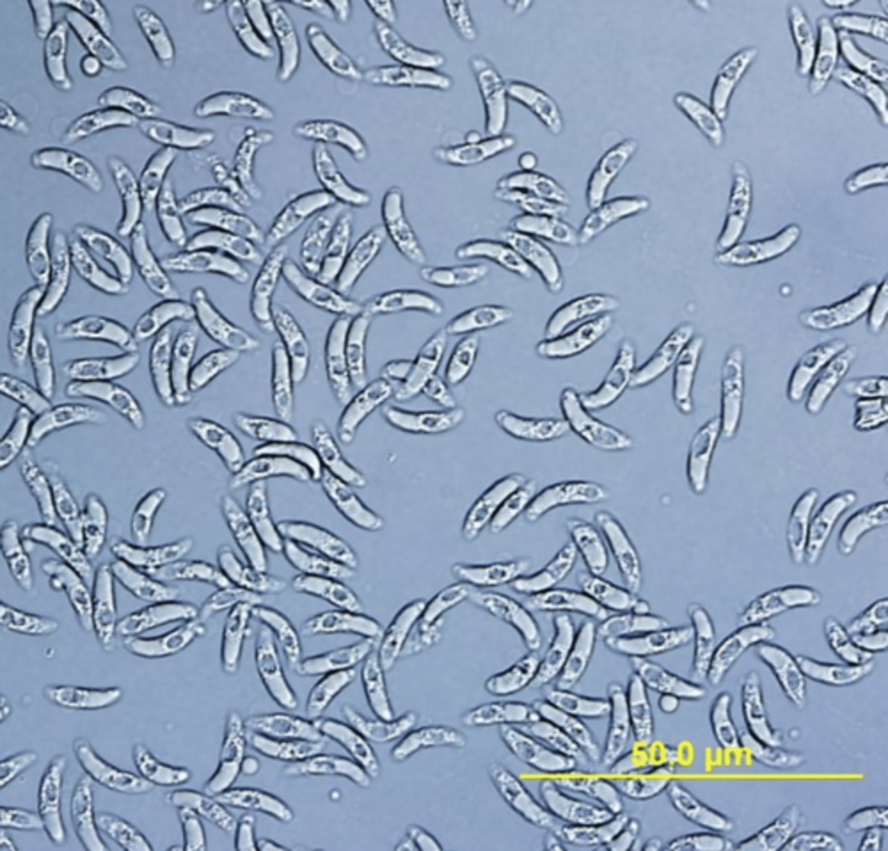 <p>Banana shaped cells</p>