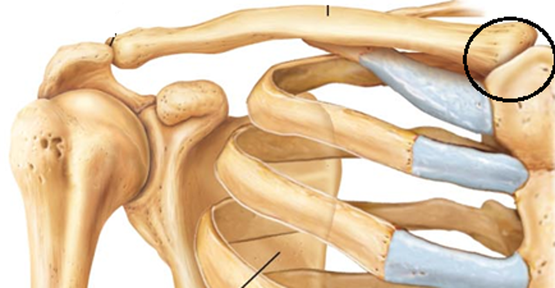 <p>Sternoclavicular joint</p>