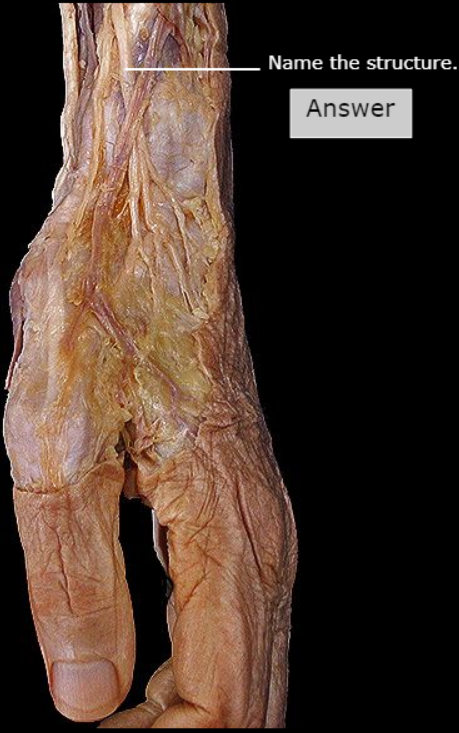 <p>What nerve is this</p>