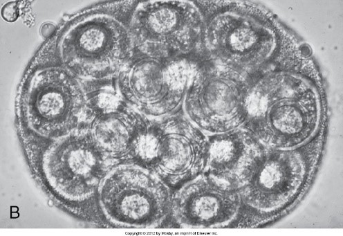 what type of hexacanth is this