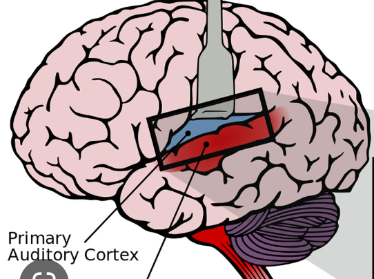 what is the function of the primary auditory cortex?