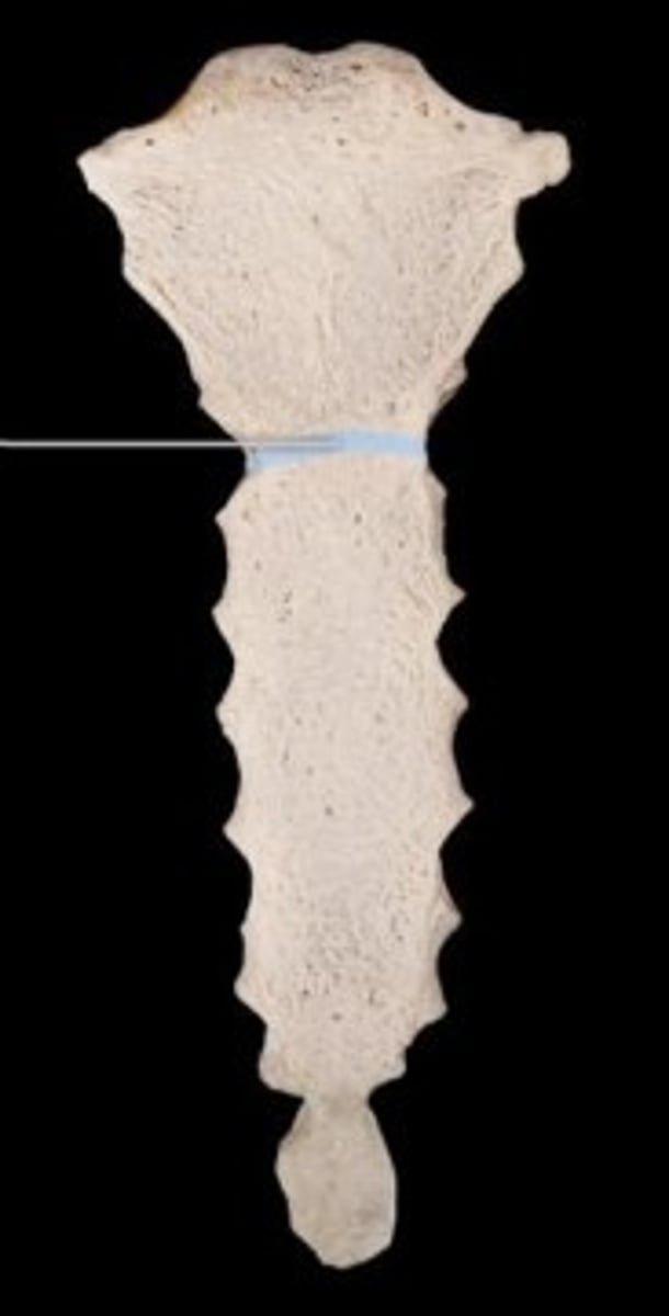 <p>The sternal angle is the junction between the manubrium and the body of the sternum. It is a reference point for the base of the heart and where the 2nd rib attaches to the sternum. It also aligns with the T4 and T5 thoracic vertebrae</p>