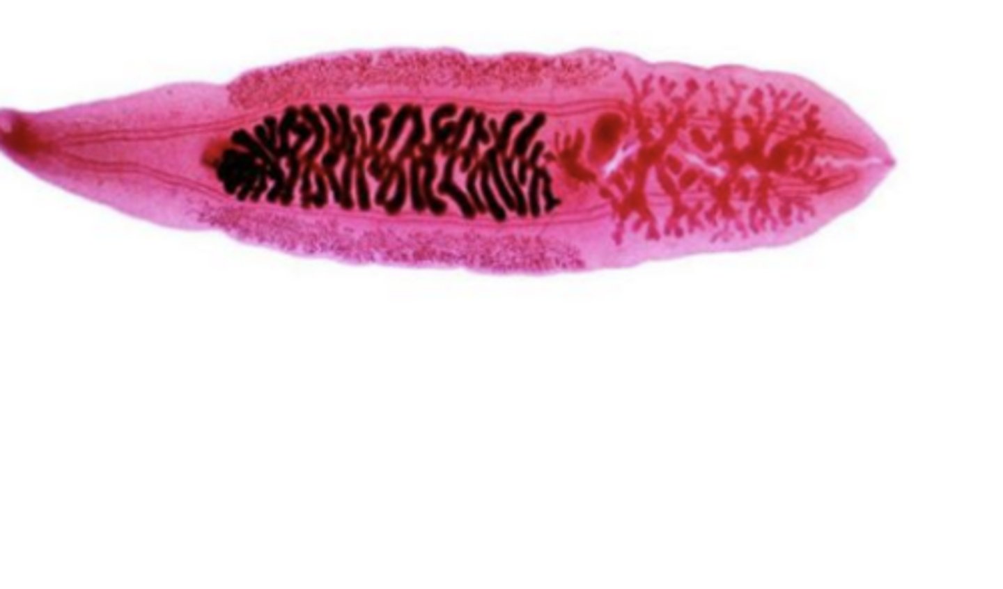 <p>Clonorchis (human liver fluke) - Trematoda</p>