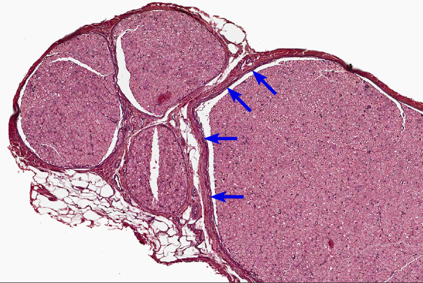 <p><span style="color: rgb(38, 38, 38)">The ________ form a compact wrapping around fascicles that contributes to the protective blood-nerve barrier. These cells are squamous, exhibiting epithelial features, such as individual basal laminae and tight junctions. However, they also contract, possessing large numbers of actin filaments, and synthesize collagen. Thus, they also resemble smooth muscle cells and fibroblasts.</span></p>