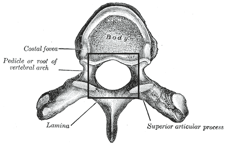 <p>Vertebra Location:</p>
