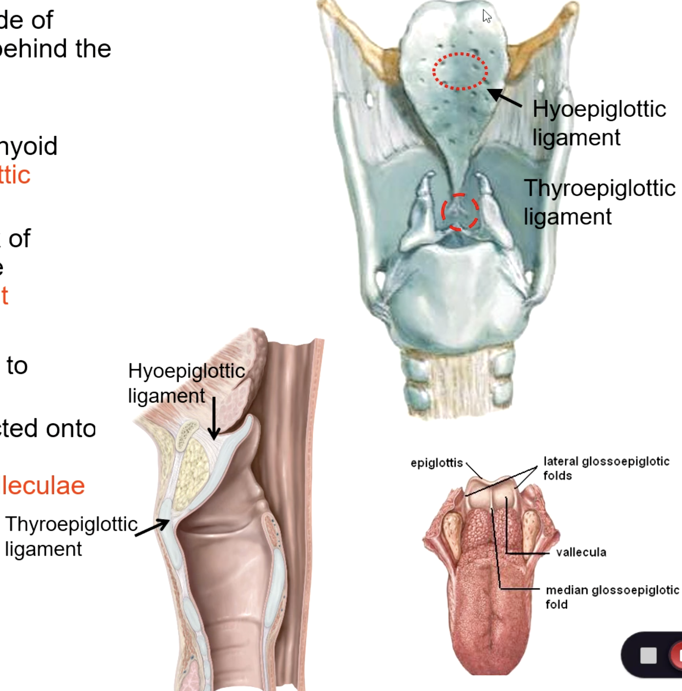 <p>thyroepiglottic ligament</p>