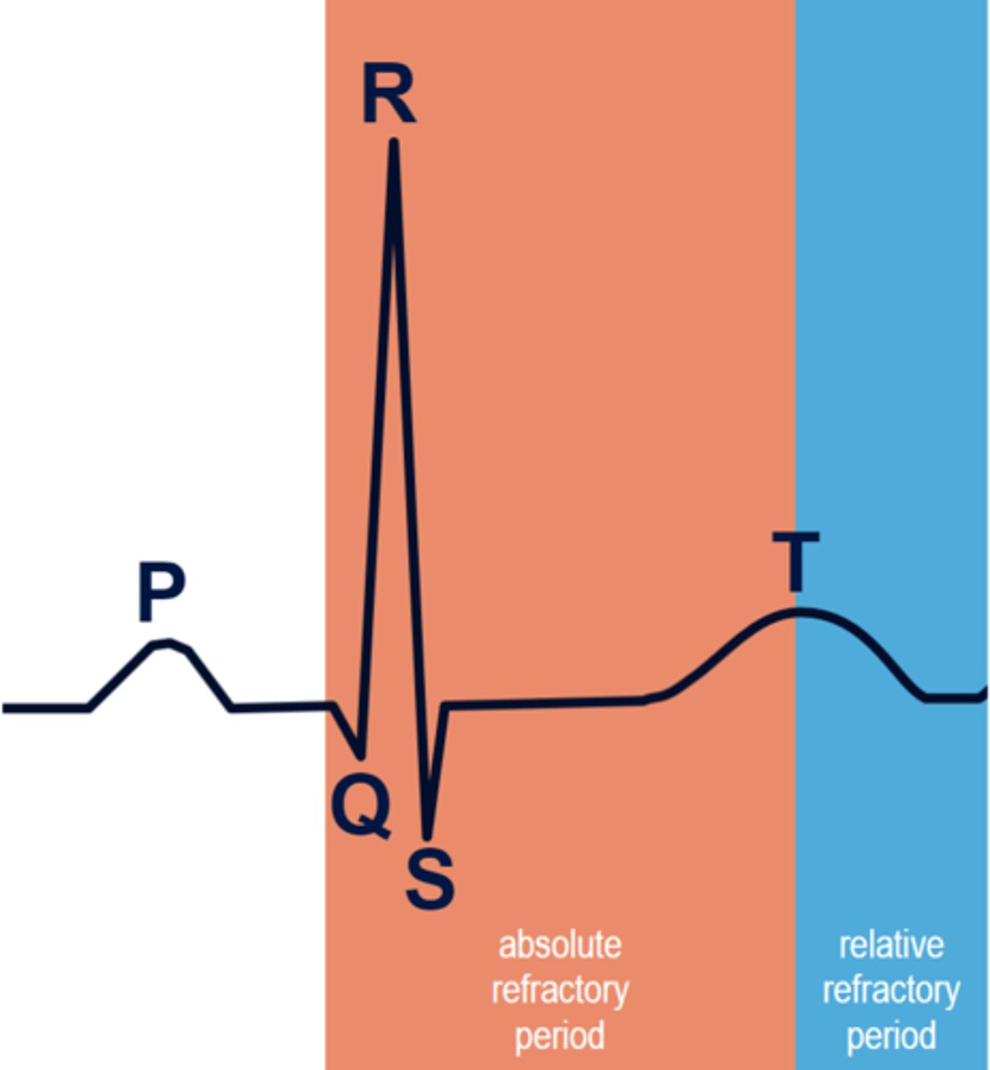 <p>Danger zone</p><p>Cardiac cells can be stimulated to depolarize if the stimulus is strong enough</p><p>This is why cardioversion has a sync button to time the shock exactly; shocking during RRP could cause a patient to go into V-fib a lethal rhythm</p>