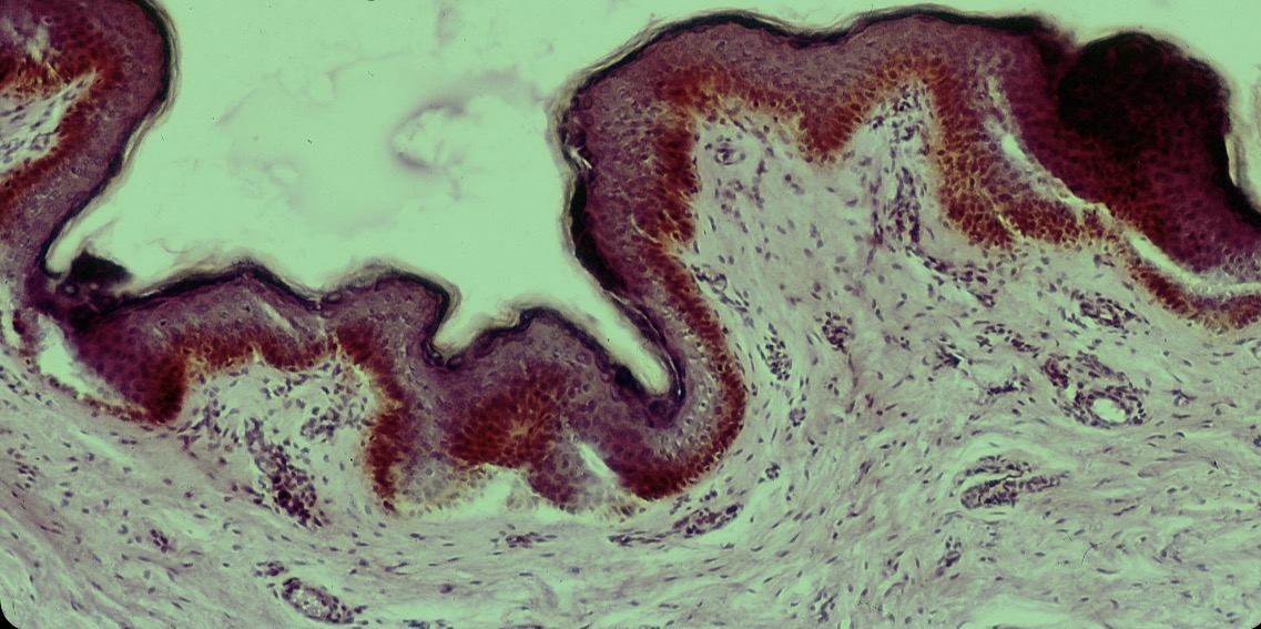 <p>Célula epitelial melánica</p>