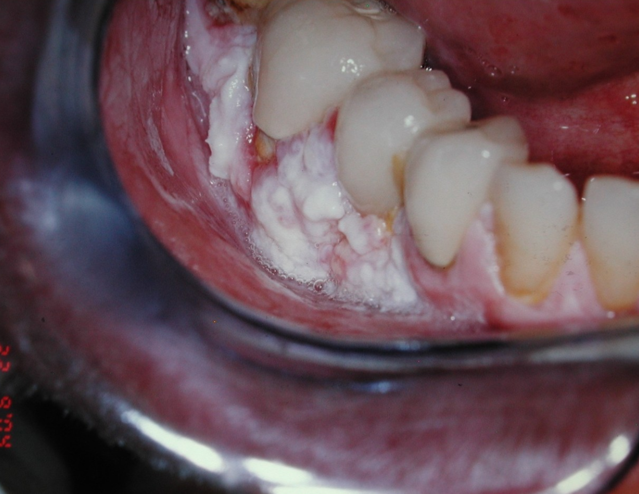 <p>6d. What is the appropriate management?</p>