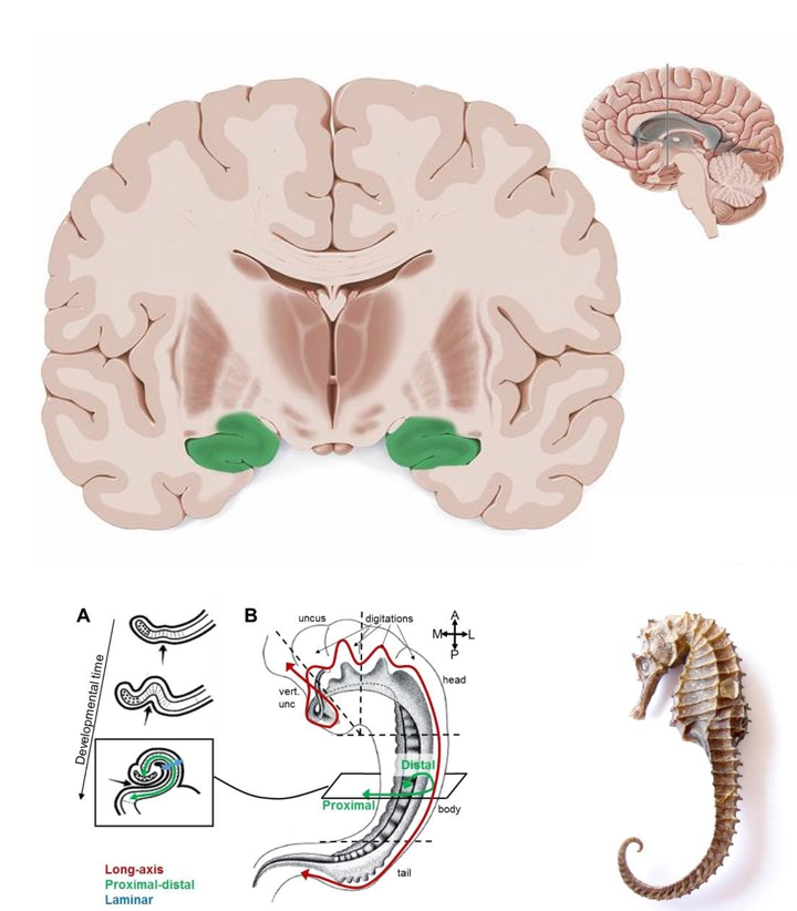 <p>Mediale temporale kwab</p><p>Kritische rol bij <strong>codering van contextuele & emotionele info</strong> + waarborging van LT opslag van <strong>episodische herinneringen</strong></p><ul><li><p><u>dorsale hippocampus</u>: ruimtelijke oriëntering & opslag van episodische herinneringen</p></li><li><p><u>ventrale hippocampus</u>: verwerking emotionele info</p></li></ul><p></p>