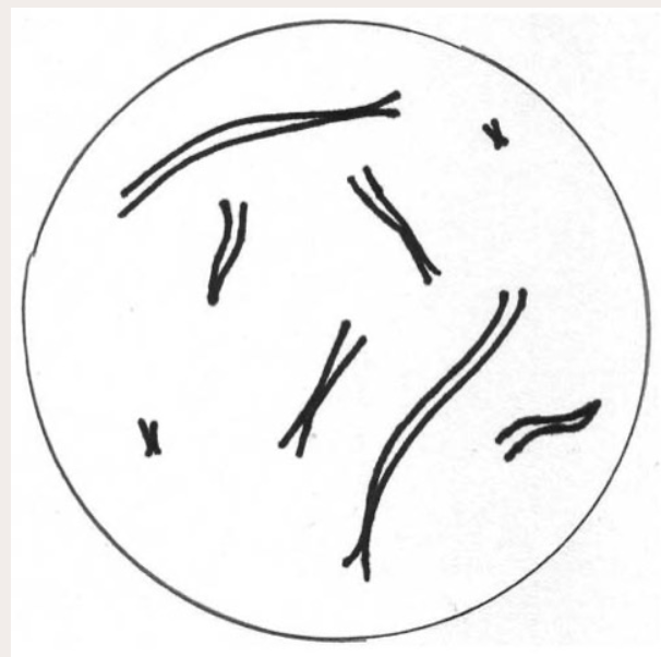 <p>How many chromosomes are in this cell? Are they replicated or unreplicated?</p>