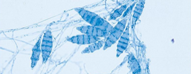 <p>What is this? (Bonus points for species) </p>