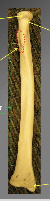 <p>What are the components of the radius? how do you know what is proximal dn distal? left and right? anterior and posteirior`</p>