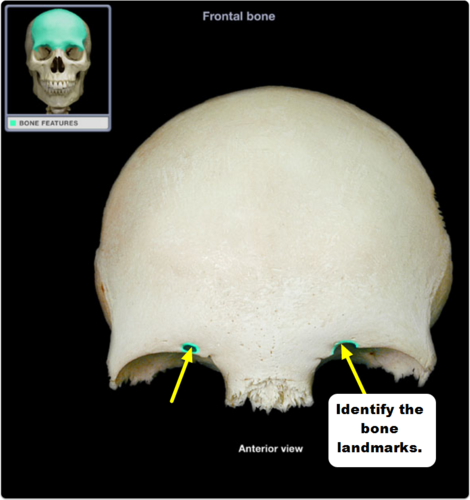 structure located just medial to the center of the superior orbital margin that transmits its namesake nerve, artery, & vein