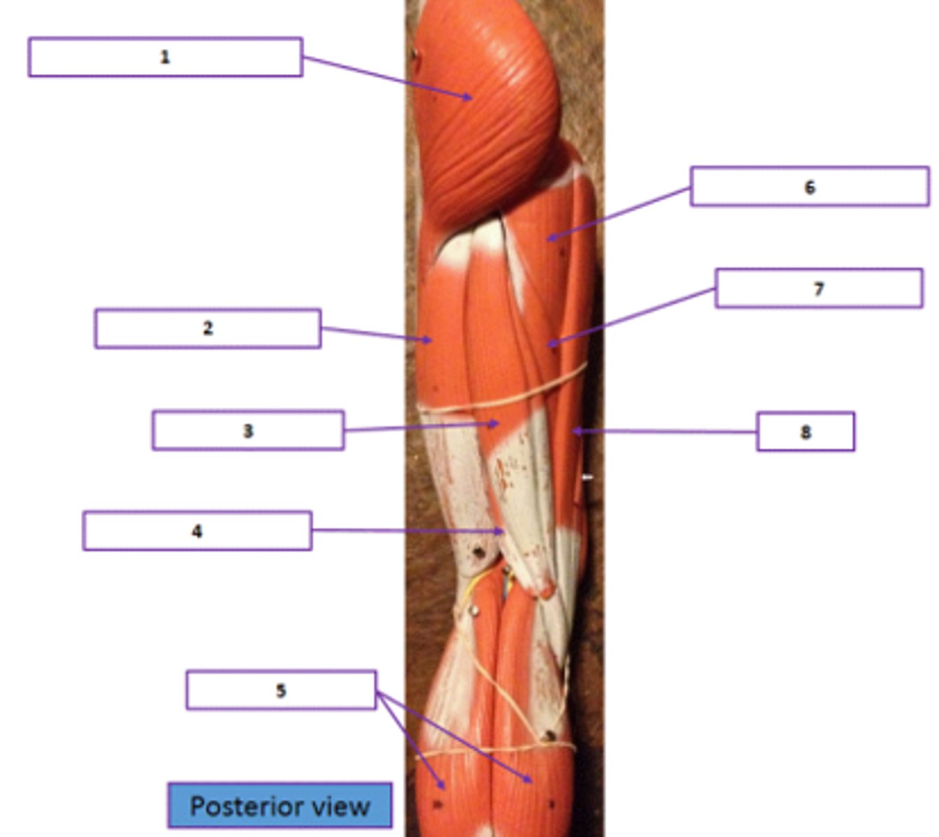 <p>Identify the muscle labeled 1.</p>