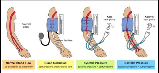 <ul><li><p><span style="background-color: transparent;"><span>Inflate cuff around upper arm to stop blood flow, then slowly release air while listening for blood flow sounds through brachial artery</span></span></p></li><li><p><span style="background-color: transparent;"><span>Systolic pressure recorded first when first sound heard, then diastolic pressure recorded when sound disappears</span></span></p></li></ul><p></p>