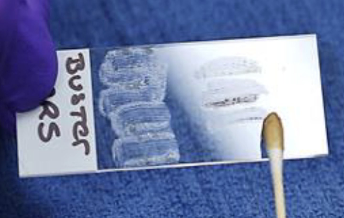 <p>What slide prep method is this?</p>