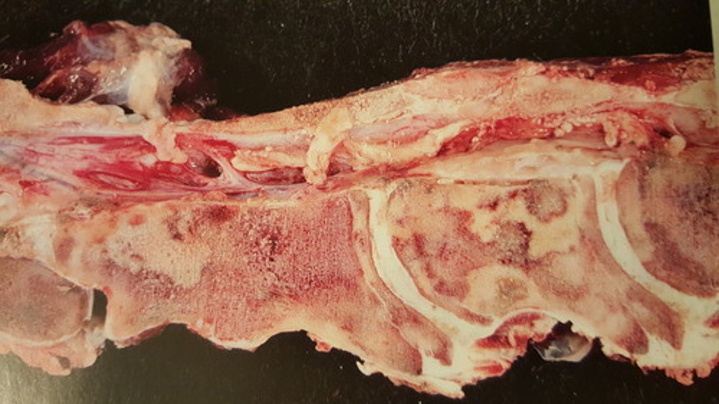 <p>Rygsøjle fra okse. Patoanatomisk diagnose?</p>