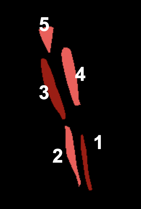 <ol><li><p>Tibialis Anterior (deceleration muscle—on shin, absorbs force)</p></li><li><p>Gastrocnemius</p></li><li><p>Hamstrings</p></li><li><p>Quadriceps</p></li><li><p>Gluteus Medius (Helps stabilize—not sway)</p></li></ol><p></p>