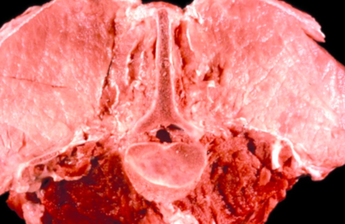 <p>What is happening in this pig specimen?</p>
