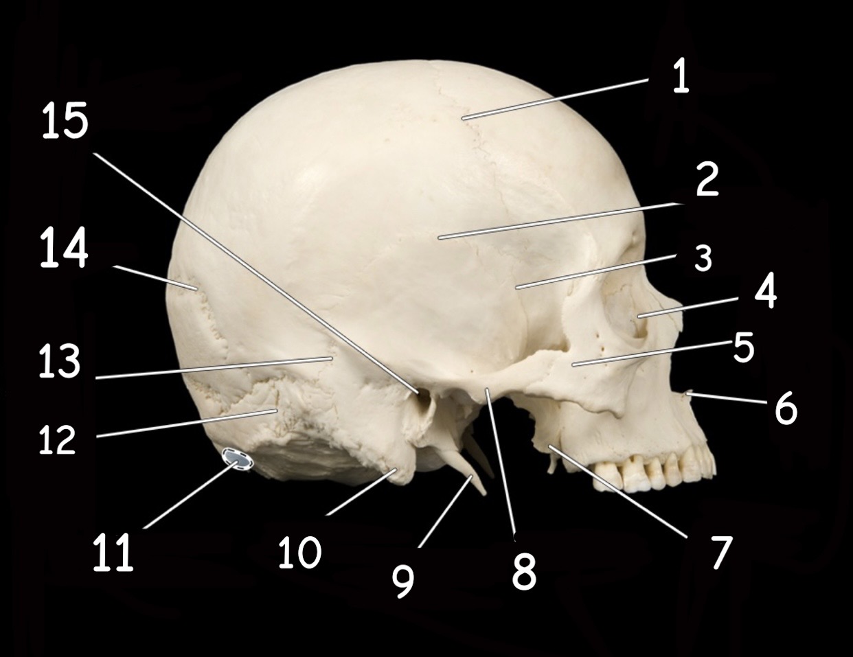term image