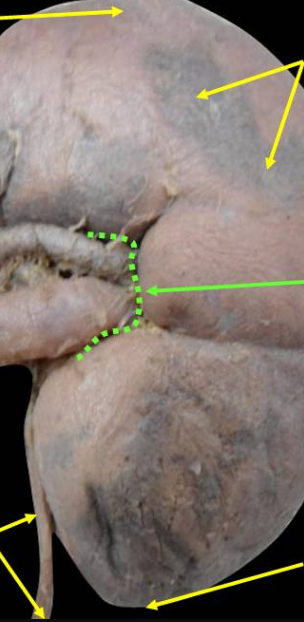 <p>What is the green line </p>