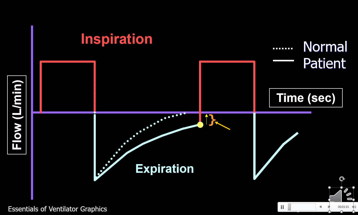 <p>What is shown in the picture?</p>