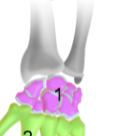 <p>Carpal bones</p>