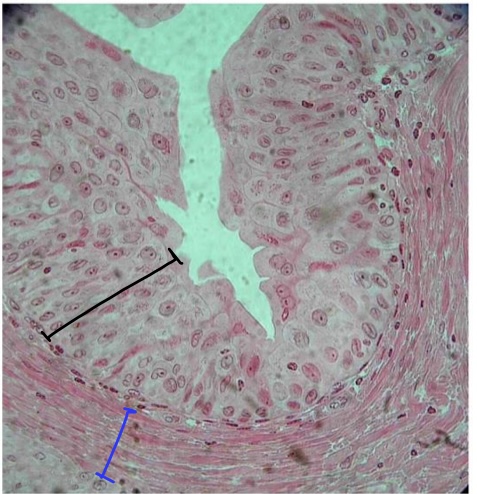 <p>specimen in field of view</p><p>specific tissue in black bracket</p><p>specific layer &amp; tissue in blue bracket</p>