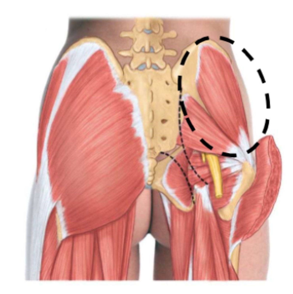 <p>Greater trochanter of femur.</p>