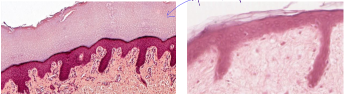 <ul><li><p>2+ later squamous cells with keratin on apical side (no nuclei in keratin)</p></li><li><p>found on skin</p></li><li><p>surface cells are squamos</p></li><li><p>protective</p></li></ul><p></p>