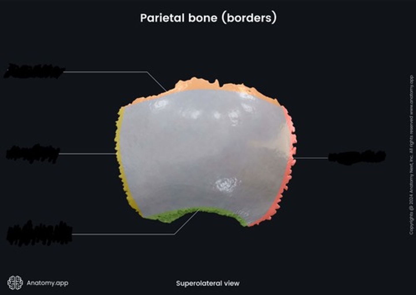 <p>what border of the parietal is this? (Red)</p>