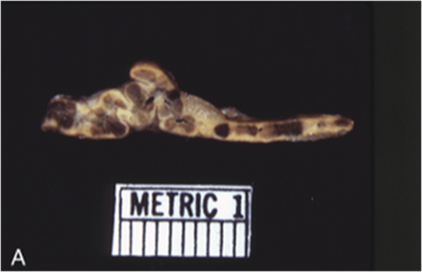 <p>Identify the pathology</p>