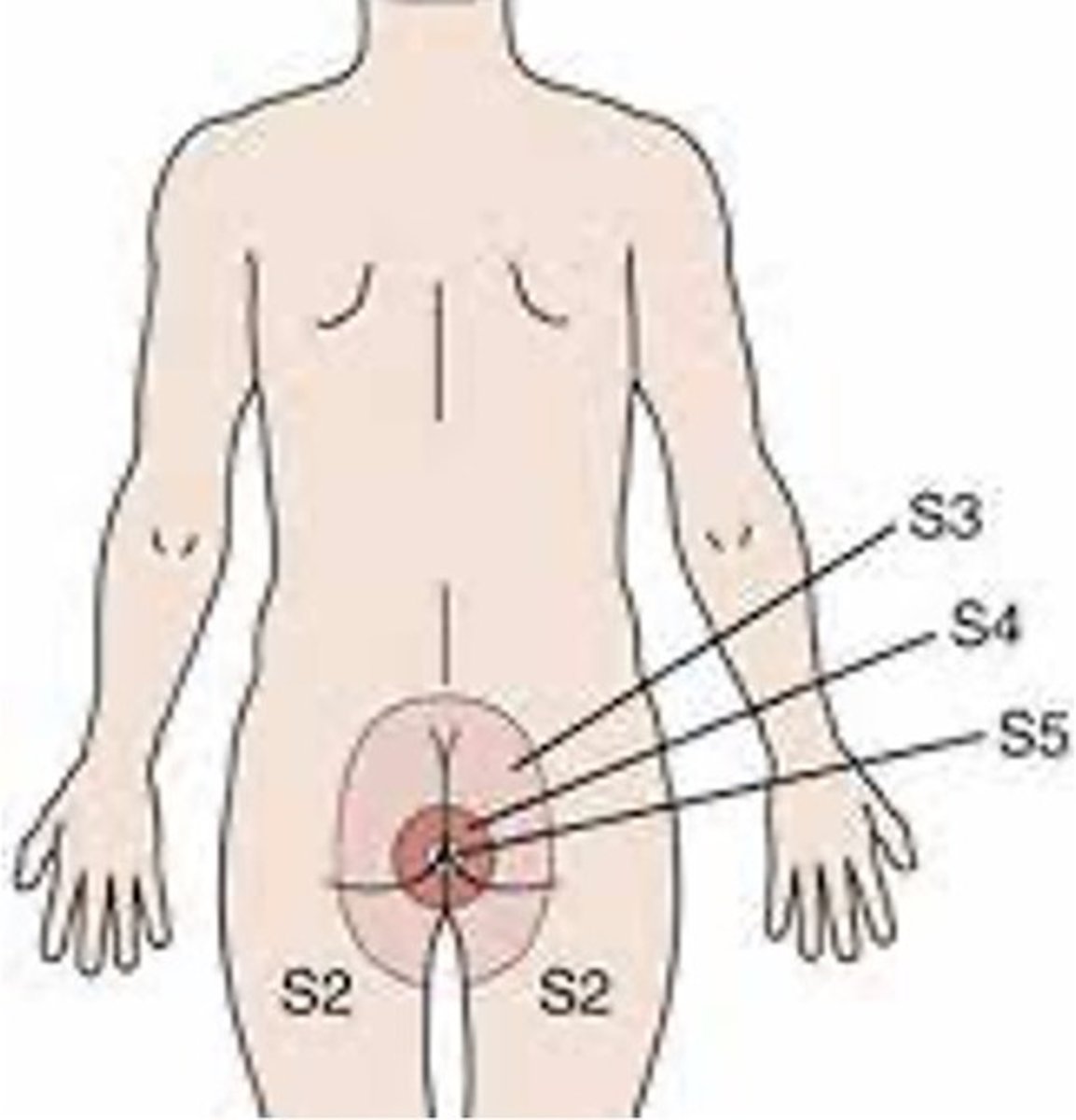 <p>Clinical Presentation</p><p>(cauda equina)</p>
