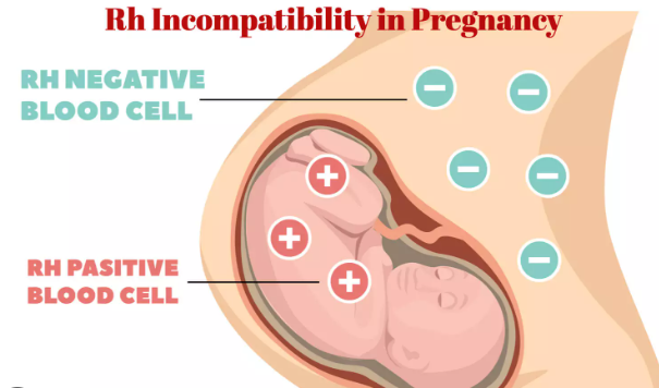indicates +/-  designation of blood type and whether the blood of two different people is compatible when mixed