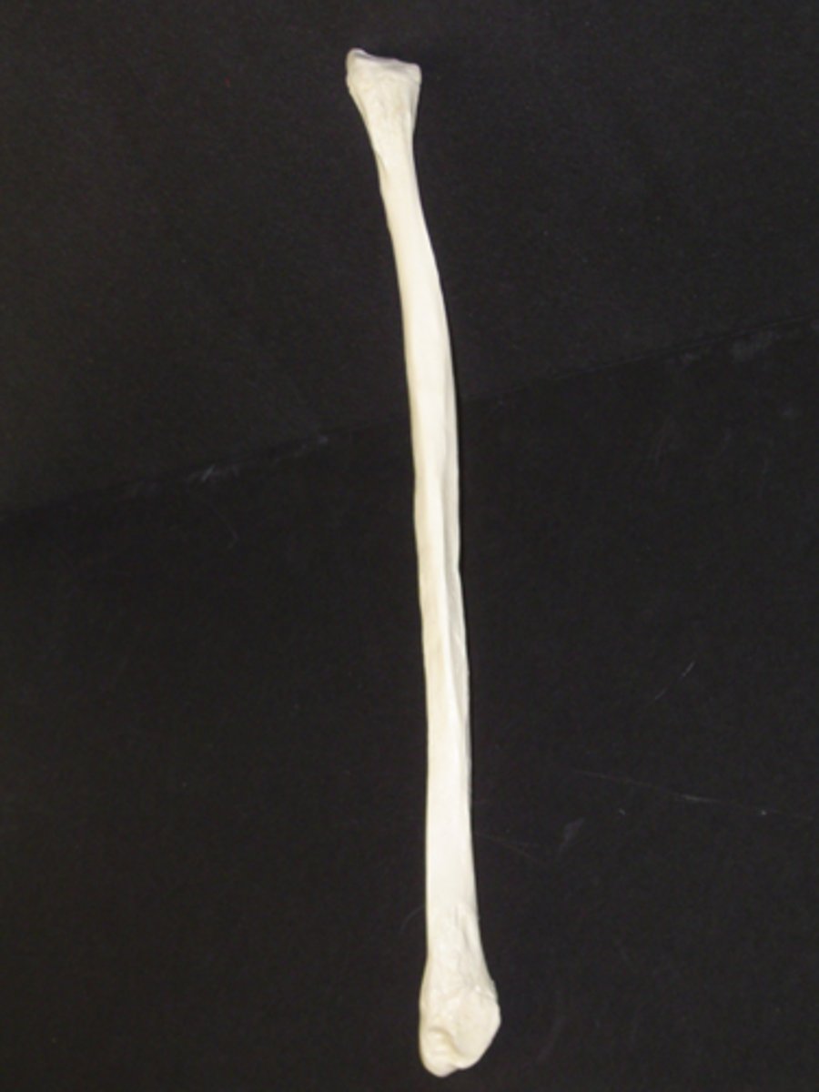 <p>right or left?</p>