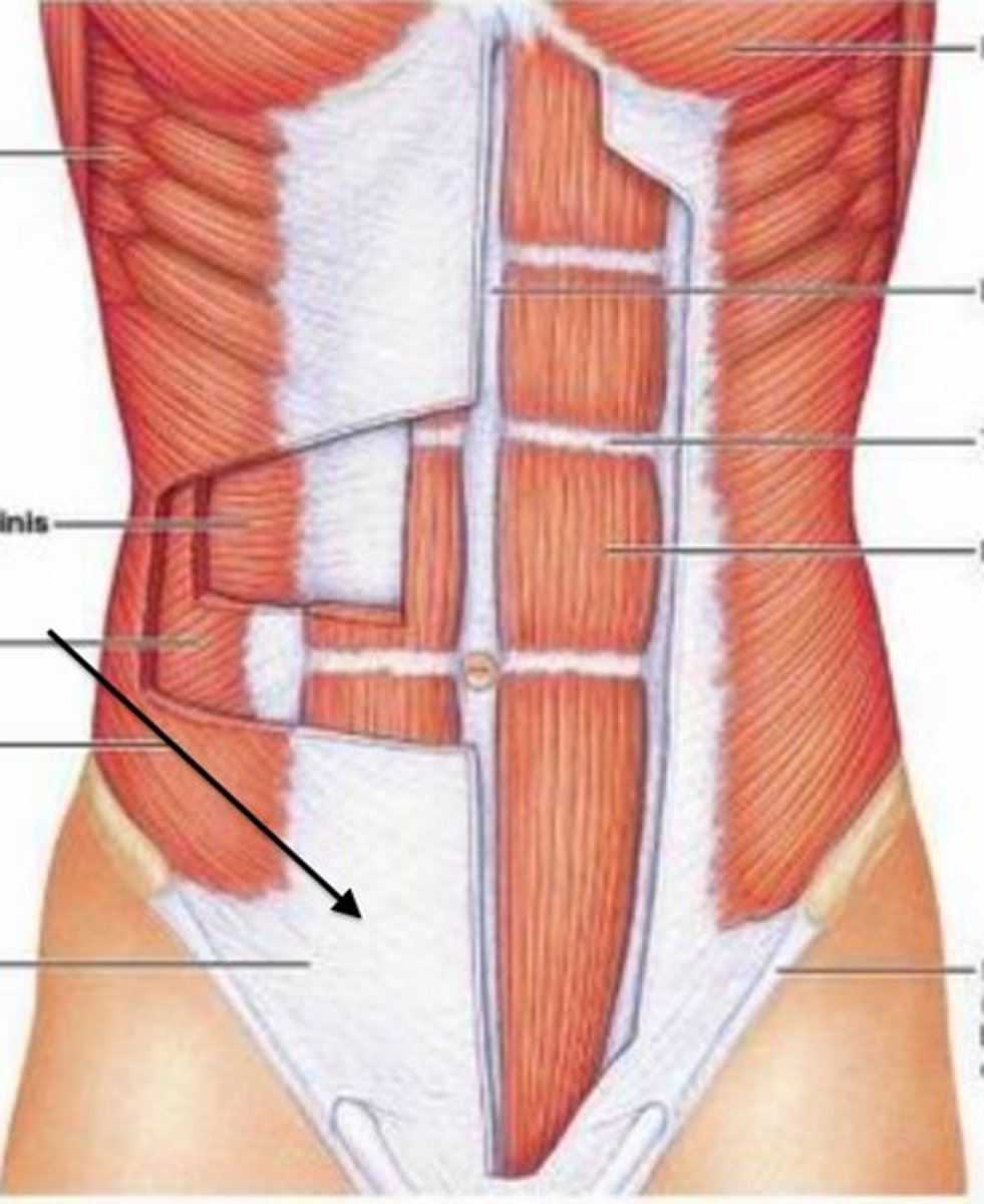 <p>Superior attachments:</p><p>- Lower fibers of pectoralis major</p><p>- Xiphoid process of sternum</p><p>- Costal cartilages</p><p>Inferior attachments:</p><p>- Pubic symphysis</p><p>- Anterior iliac spine via inguinal ligament</p><p>At midline, visible as thick fibrous band called linea alba</p><p>Moving Laterally:</p><p>- Divides into internal and external sheath which surround the Rectus Abdominus</p><p>- Sheaths come together again to form linea semilunaris</p><p>- Sheaths separate into four layers that separate transverse abdominus, the internal obliques and external obliques</p><p>T.I.E.</p><p>- Three layers moving from deeper to superficial</p><p>- RA is not layered with others</p>