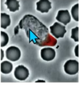 <p>responsible for contractile behaviour</p><p>in a normal cell, Rho GTP activation occurs at “back” of the cell </p><p>(eg. this neutrophil chase)</p>